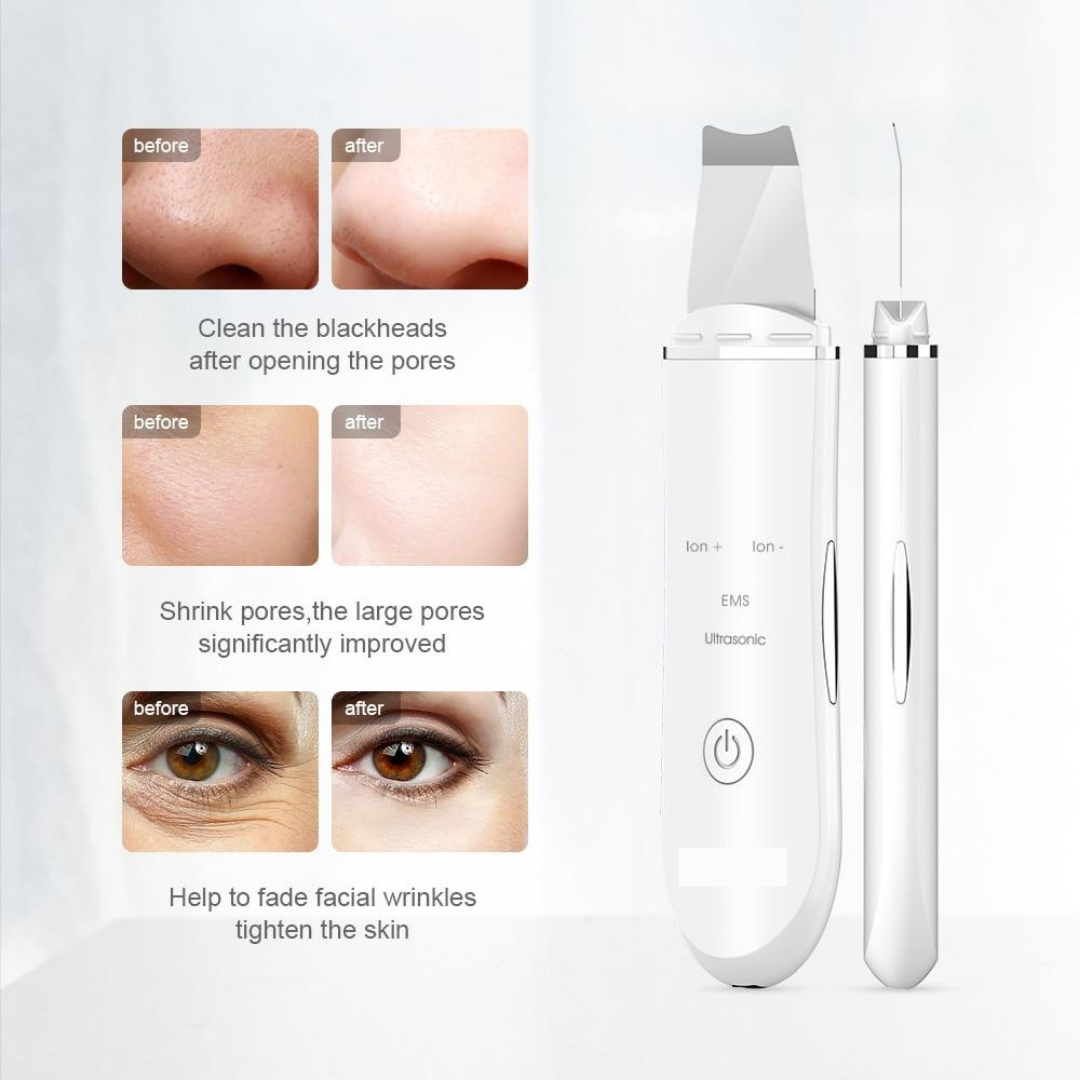 Lushtic Ultrasonic Skin Scrubber Lushtic